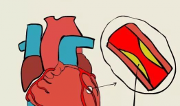 心脏漫画图,心脏结构与功能图解